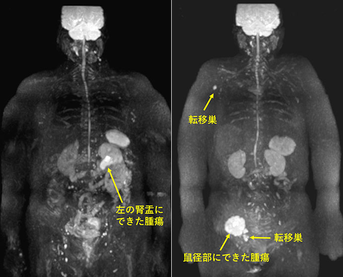 DWIBSでわかるもの